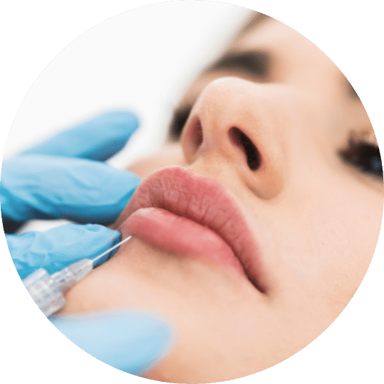 Filler behandling Ung kvinne behandles med filler og mottar injeksjon i underleppa.