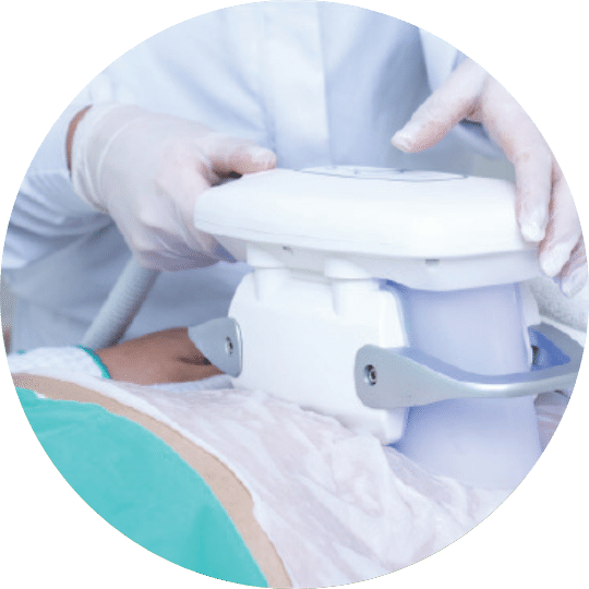 Z Lipo cryolipolyse maskin En kosmetisk sykepleier holder Zimmerapparat (Z-Lipo) over pasient ved cryolipolyse behandling.