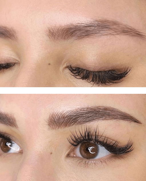 Microblading – Før Og Etter Bilder 2
