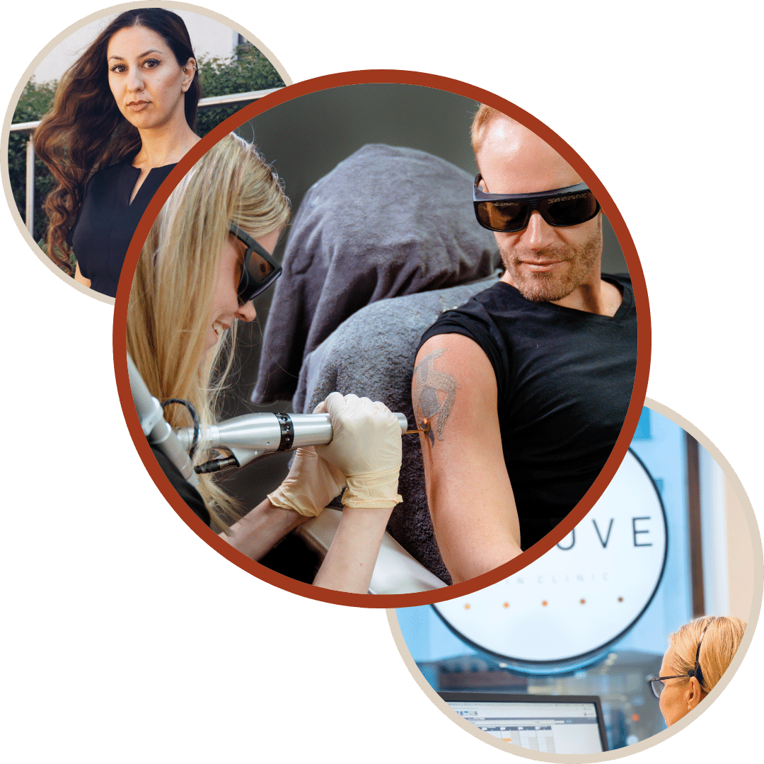 Tatoveringsfjerning med Picoway laser Behandlinger hoss Remove laserklinikken